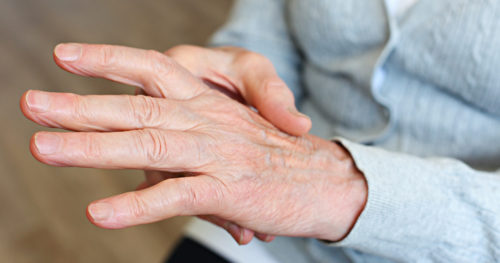 Don’t believe common myths about easing arthritis pain